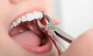 Tampa Top Dentist - Get Treatment All Teeth Problems