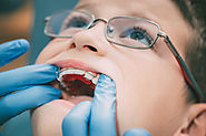 Appareil dentaire: pourquoi ? A quel âge ? Les conseils d'un orthodondiste