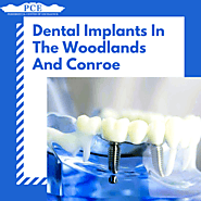 Dental Implants In The Woodlands | Perio Center