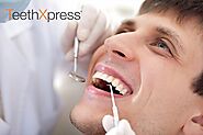 TeethXpress & Dental Implant Maintenance | PCE