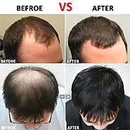 20 Ways to Stop Hair Loss in Men | How to stop hair fall for men | Hair Growth Tips | Prevent hair fall in men