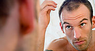 Men's Hair Loss: Treatments and Solutions With Pictures