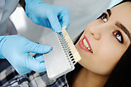 What You Should Know About Getting Composite Fillings