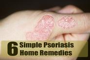 6 Simple and Effective Psoriasis Home Remedies