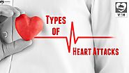 EVERYONE MUST KNOW ABOUT THE TYPES OF HEART ATTACKS