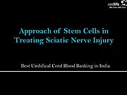 Approach of Stem Cells in Treating Sciatic Nerve Injury