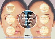 Facelifts: What You Need to Know