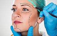4 Surprising Facts You Didn’t Know About Cosmetic Surgery