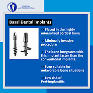 Basal Dental Implants