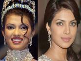 The Reality Behind Priyanka Chopra Plastic Surgery