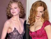 Nicole Kidman Plastic Surgery To Enhance Her Breast Size