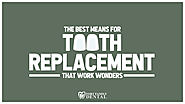 The Best Means for Tooth Replacement That Work Wonders