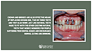 • Crown and bridges are also effective means of replacing missing one, two or three teeth and they also work just lik...
