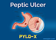 Comprehensive Outlook of Peptic Ulcer Disease