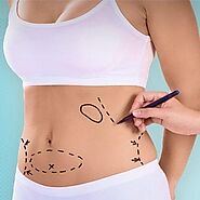 Lose Belly Fat and Get a Flat Stomach With Laser Liposuction