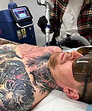 Darshit Shah's answer to What is Laser Tattoo removal? Is it bad for skin? - Quora