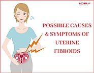POSSIBLE CAUSES & SYMPTOMS OF UTERINE FIBROIDS
