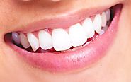 Finding the Best Teeth Whitening Dentist is Easier than You Think — Posh Beauty Blog