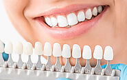 What Patients Need to Know about Dental Implants