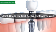 Which One Is The Best Dental Implant For You?