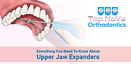 Website at https://topnovaorthodontics.com/need-to-know-about-the-upper-jaw-expanders/