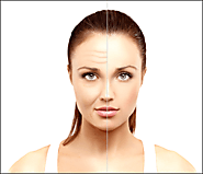 What is Botox? Why Choose Botox Injections?