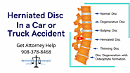 Suffer Herniated Disc in a Auto Accident