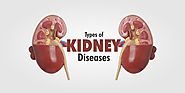 Kidney Diseases: Types, Causes & Symptoms - Shuddhi