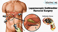 Gallbladder Treatment Cost in Texas | USA | Contact US
