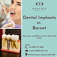 Dental Implants Barnet