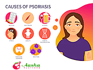 Psoriasis Treatment in Ayurveda & Panchkarma – by Dr.Chanchal Sharma | Site Title