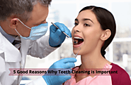 5 Good Reasons Why Teeth Cleaning is Important | Ahmedabad Dental