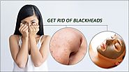 How to get rid of Blackheads instantly with these simple tips and tricks