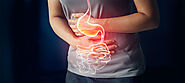 Ulcerative Colitis : Causes I Symptoms I Diagnosis ITreatment I Diet