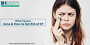 What are the Main Causes of Acne and How to Clear it from Skin?