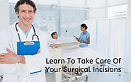 Laparoscopic Surgery: Learn To Take Care Of Your Surgical Incisions