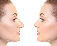 Website at https://www.dynamiclinic.com/laser-treatments/non-surgical-nose-job/
