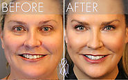 Website at https://www.dynamiclinic.com/laser-treatments/ultherapy-treatment/