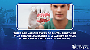 • There are various types of dental prosthesis that provide assistance in a variety of ways to help people with denta...