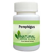 Pemphigus Natural Herbal Treatment, Key Facts, Symptoms, Causes - Natural Herbs Clinic
