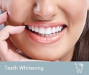 7 Reasons Why You Should Go for Teeth Whitening Treatment - Beauty Around The Corner