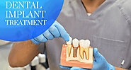 Ashton Avenue Dental Practice: Reasons Why Dental Implants Are Important