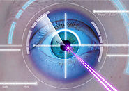 Laser Cataract Surgery in Kolkata | Femto Eye Surgery | Radiant Eye Foundation