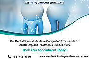Dental Implants are a Long-Term Investment for Your Smile