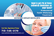Why Choose Dental Implants for Single Tooth Replacement