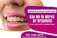 Why Choose Invisalign Braces for your teeth