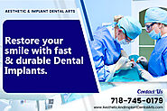 Frequently Asked Questions Regarding Dental Implants