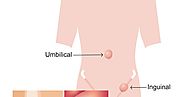 Hernia treatment in Surat Professionals are experiencing the causes symptoms and more