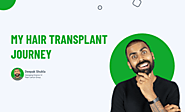 What does getting a Hair Transplant look like?