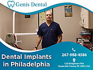 Get The Best Dental Implants In Huntingdon Valley